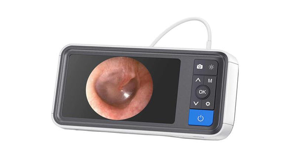 Endoscope with digital display showing an internal view on a white background